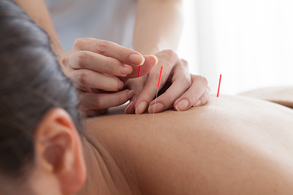 acupuncture ajax