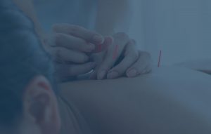 medical acupuncture ajax