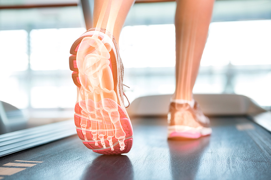 Do You Really Need Custom Made Orthotics for Running? - Runners